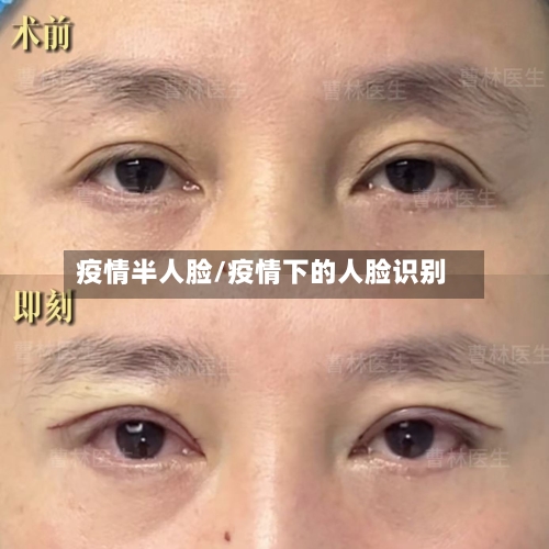 疫情半人脸/疫情下的人脸识别-第2张图片