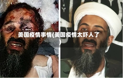 美国疫情事情(美国疫情太吓人了)