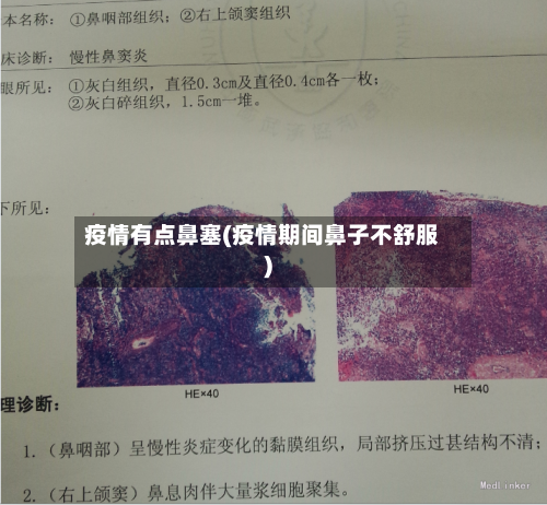 疫情有点鼻塞(疫情期间鼻子不舒服)-第2张图片
